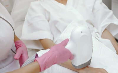 What to Expect During a Laser Hair Removal Session